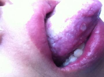 吃瓜吃的舌头疼嘴唇疼,揭秘吃瓜成瘾背后的健康隐患